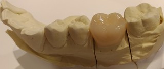 P_20171215_152926_vHDR_Auto_1.jpg