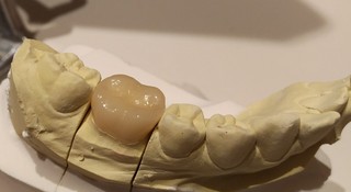 P_20171215_153128_vHDR_Auto_1.jpg